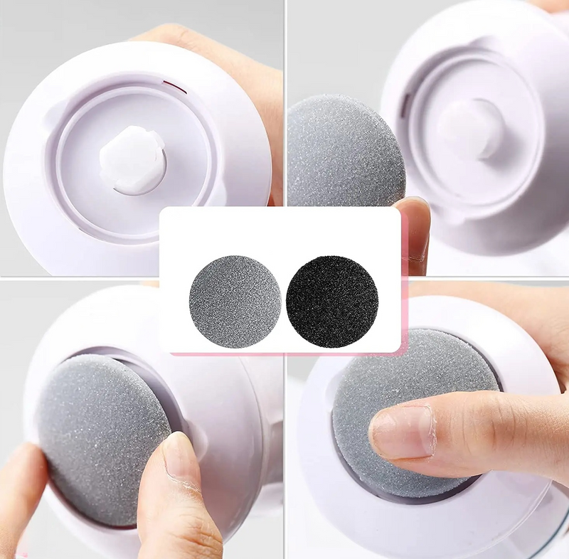 Removedor de Calos e Rachaduras